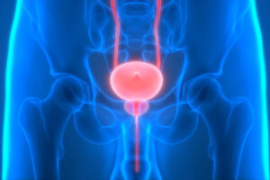 cirugía láser urológica HoLEP y tratamientos mínimamente invasivos.