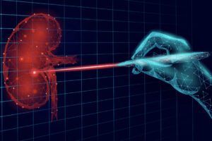 cirugía láser urológica HoLEP y tratamientos mínimamente invasivos.